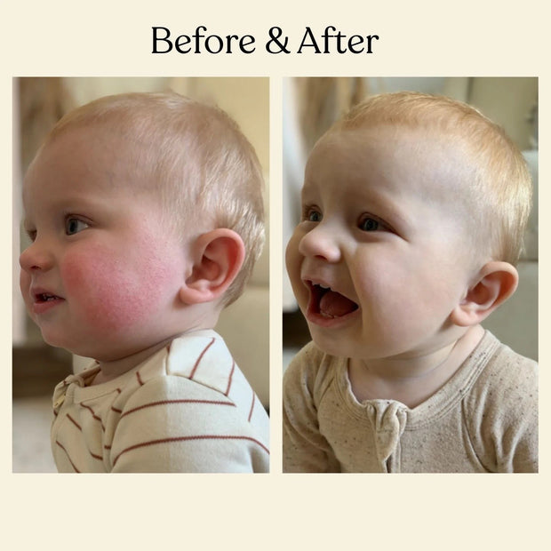 Crema facial hidratante para bebés
