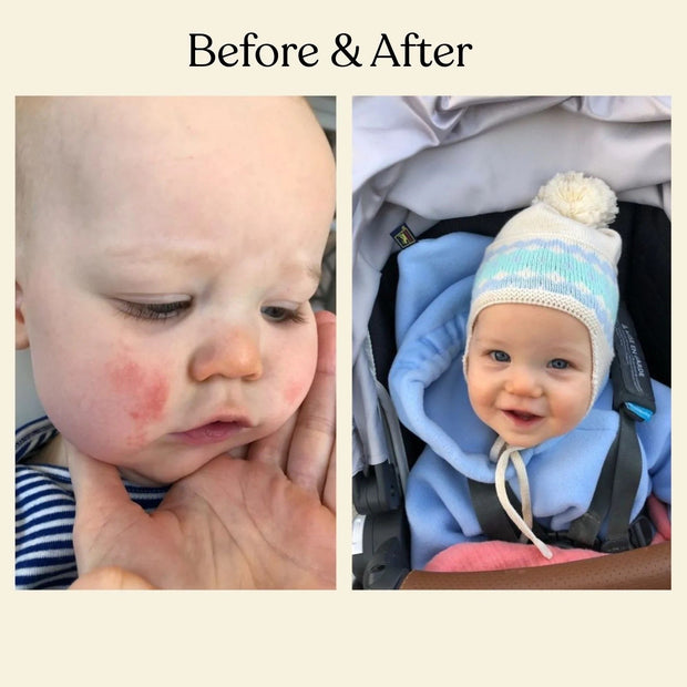 Moisturizing Baby Face Cream